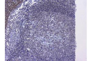 IHC analysis of NRF1 using anti-NRF1 antibody (ABIN6719347).