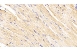 Detection of TIMP2 in Mouse Cardiac Muscle Tissue using Polyclonal Antibody to Tissue Inhibitors Of Metalloproteinase 2 (TIMP2) (TIMP2 抗体  (AA 27-220))