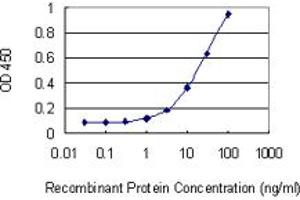 Detection limit for recombinant GST tagged CHODL is 0. (CHODL 抗体  (AA 23-94))
