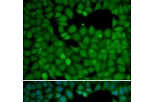 Immunofluorescence analysis of HeLa cells using NET1 Polyclonal Antibody