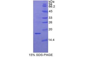 SDS-PAGE (SDS) image for Retinol Binding Protein 2, Cellular (RBP2) (AA 1-134) protein (His tag) (ABIN1879330)
