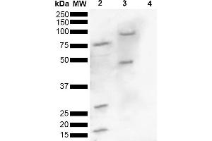 Western blot analysis of Human, Mouse brain lysate showing detection of ~16 kDa Alpha Synuclein pSer129 protein using Rabbit Anti-Alpha Synuclein pSer129 Polyclonal Antibody (ABIN5650949). (SNCA 抗体  (pSer129) (HRP))