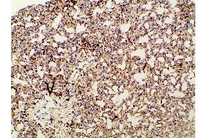 Immunohistochemistry (IHC) image for anti-Phosphoinositide 3 Kinase, p85 alpha (PI3K p85a) (pTyr607) antibody (ABIN6256775)