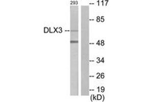Western blot analysis of extracts from 293 cells, using DLX3 Antibody. (DLX3 抗体  (AA 71-120))