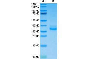 SDS-PAGE (SDS) image for C-Type Lectin Domain Family 12, Member A (CLEC12A) (AA 65-267) protein (His tag) (ABIN7274361)