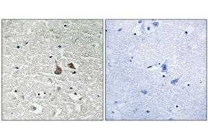 Immunohistochemical analysis of paraffin-embedded human brain tissue using IRAK1 (Phospho-Ser376) antibody (left)or the same antibody preincubated with blocking peptide (right). (IRAK1 抗体  (pSer376))