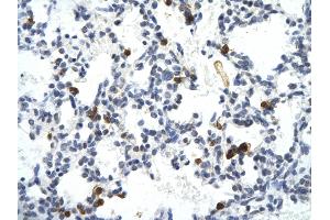 Rabbit Anti-E2F6 antibody        Paraffin Embedded Tissue:  Human Lung cell   Cellular Data:  Epithelial cells of renal tubule  Antibody Concentration:   4. (E2F6 抗体  (Middle Region))