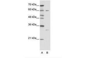 Image no. 1 for anti-Zinc Finger Protein 395 (ZNF395) (AA 361-410) antibody (ABIN6736114) (ZNF395 抗体  (AA 361-410))