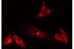 ABIN6274763 staining HuvEc cells by IF/ICC.