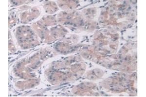 IHC-P analysis of Human Stomach Tissue, with DAB staining. (KEAP1 抗体  (AA 327-624))