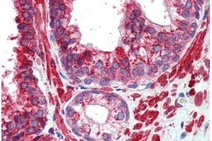 Immunohistochemistry (Paraffin-embedded Sections) (IHC (p)) image for anti-Transcription Factor AP-2 gamma (Activating Enhancer Binding Protein 2 Gamma) (TFAP2C) (AA 252-301) antibody (ABIN6741554)