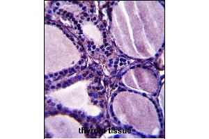 TRIM23 Antibody (N-term) (ABIN657564 and ABIN2846571) immunohistochemistry analysis in formalin fixed and paraffin embedded human thyroid tissue followed by peroxidase conjugation of the secondary antibody and DAB staining. (TRIM23 抗体  (N-Term))