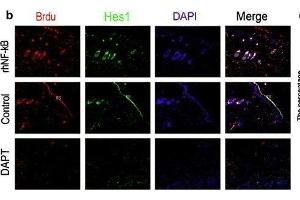 The relationships of the Wnt and Notch signaling pathway and the proliferation of epidermal stem cells was analyzed by immunofluorescence. (HES1 抗体  (AA 41-150))
