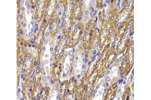 Immunohistochemistry of paraffin-embedded Rat kidney using ATP1A1 Polyclonal Antibody at dilution of 1:100 (40x lens). (ATP1A1 抗体)