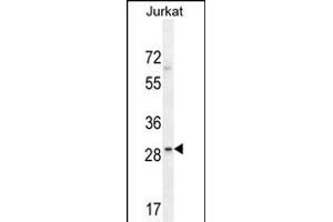 LRRC25 Antibody (C-term) (ABIN654519 and ABIN2844242) western blot analysis in Jurkat cell line lysates (35 μg/lane). (LRRC25 抗体  (C-Term))