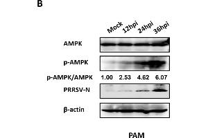 Western Blotting (WB) image for anti-Protein Kinase, AMP-Activated, alpha 1 Catalytic Subunit (PRKAA1) (AA 1-300) antibody (ABIN3021788)
