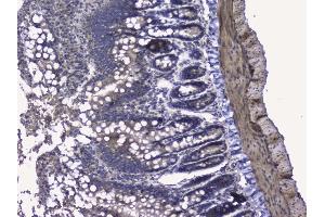IHC analysis of RALBP1 using anti-RALBP1 antibody (ABIN5692936). (RALBP1 抗体  (AA 239-506))