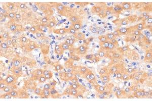 Immunohistochemistry of paraffin-embedded Human liver using PDCD2L Polyclonal Antibody at dilution of 1:100 (40x lens). (PDCD2L 抗体)