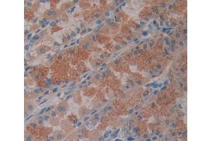 Immunohistochemistry (IHC) image for anti-ATP-Binding Cassette, Sub-Family B (MDR/TAP), Member 8 (ABCB8) (AA 472-735) antibody (ABIN5013189)