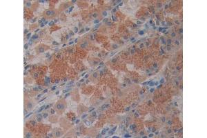 Used in DAB staining on fromalin fixed paraffin- embedded stomach tissue (ABCB8 抗体  (AA 472-735))
