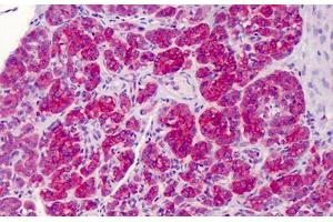 Human Pancreas: Formalin-Fixed, Paraffin-Embedded (FFPE) (FANCC 抗体  (C-Term))