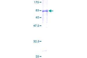 PEPD Protein (AA 1-493) (GST tag)