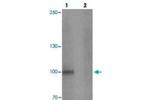 Western blot analysis of STOX1 in human liver tissue with STOX1 polyclonal antibody  at 1 ug/mL in (lane 1) the absence and (lane 2) the presence of blocking peptide. (STOX1 抗体  (C-Term))