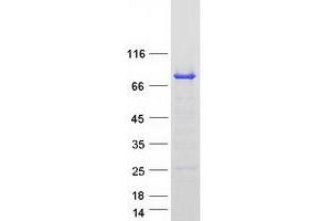 Validation with Western Blot