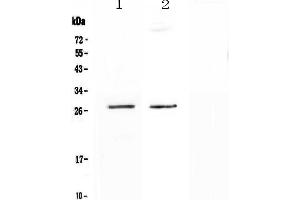 Western blot analysis of SPR using anti-SPR antibody . (SPR 抗体  (AA 36-261))