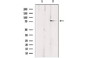 Western Blotting (WB) image for anti-ATP-Binding Cassette, Sub-Family B (MDR/TAP), Member 10 (ABCB10) (Internal Region) antibody (ABIN6257917)