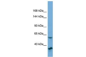 Host:  Rabbit  Target Name:  OSBP2  Sample Type:  OVCAR-3 Whole cell lysates  Antibody Dilution:  1. (OSBP2 抗体  (N-Term))