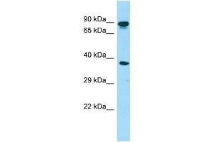 WB Suggested Anti-HOOK3 Antibody Titration: 1. (HOOK3 抗体  (C-Term))