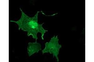 Anti-LIMK1 mouse monoclonal antibody (ABIN2454574) immunofluorescent staining of COS7 cells transiently transfected by pCMV6-ENTRY LIMK1 (RC218058). (LIM Domain Kinase 1 抗体)