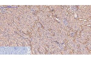 Immunohistochemistry of paraffin-embedded Rat kidney tissue using CD5 Monoclonal Antibody at dilution of 1:200. (CD5 抗体)