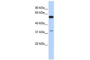 DDX28 antibody used at 1 ug/ml to detect target protein. (DDX28 抗体)