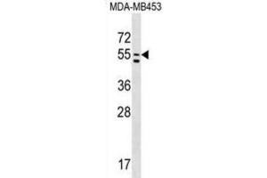 Western Blotting (WB) image for anti-phosphatidylserine Synthase 1 (PTDSS1) antibody (ABIN2999231) (PTDSS1 抗体)