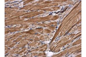 Immunohistochemistry (IHC) image for anti-Citrate Synthase (CS) antibody (ABIN2856769)