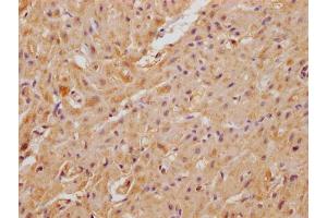 IHC image of ABIN7175041 diluted at 1:100 and staining in paraffin-embedded human heart tissue performed on a Leica BondTM system. (C22ORF39 抗体  (AA 1-142))
