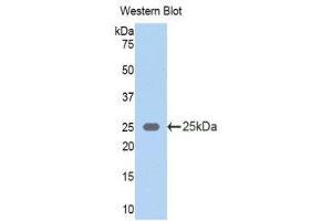 Western Blotting (WB) image for anti-Keratin 5 (KRT5) (AA 335-473) antibody (ABIN1172972) (Cytokeratin 5 抗体  (AA 335-473))