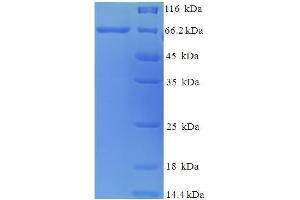 SDS-PAGE (SDS) image for Fused in Sarcoma (FUS) (AA 136-608) protein (His-SUMO Tag) (ABIN5710740)