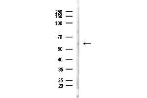 Western blot analysis of lysates from Hela cells(heat-shock, 45 min treatment), using Phospho-Smad1 (Ser465) Antibody at 1/1000 dilution.