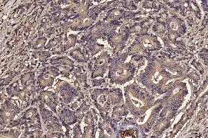 IHC analysis of PDIA6 using anti-PDIA6 antibody (ABIN7600554). (PDIA6 抗体  (AA 20-440))