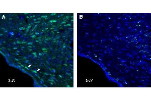 anti-G Protein-Coupled Receptor 88 (GPR88) (AA 144-157), (Intracellular), (Loop 2) antibody
