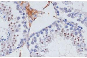 Immunohistochemistry of paraffin-embedded Mouse testis using SKIV2L2 Polyclonal Antibody at dilution of 1:100 (40x lens). (MTR4 抗体)