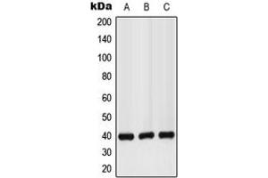 Western blot analysis of GPR160 expression in LO2 (A), mouse liver (B), rat kidney (C) whole cell lysates. (GPR160 抗体  (C-Term))