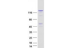 Validation with Western Blot (KDM3A Protein (Transcript Variant 2) (Myc-DYKDDDDK Tag))