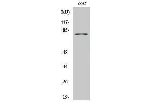 Western Blotting (WB) image for anti-Tyrosinase (TYR) (C-Term) antibody (ABIN3187389) (TYR 抗体  (C-Term))
