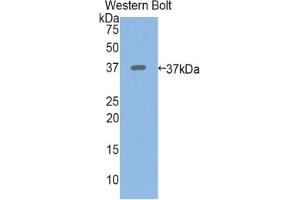 WB of Protein Standard: different control antibodies against Highly purified E.