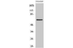 Western Blotting (WB) image for anti-Coenzyme Q8A (COQ8A) (Internal Region) antibody (ABIN3179898) (COQ8A 抗体  (Internal Region))