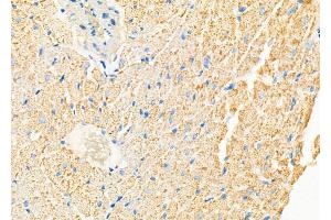 ABIN6261172 and ABIN6278112 at 1/100 staining Rat heart tissue by IHC-P.